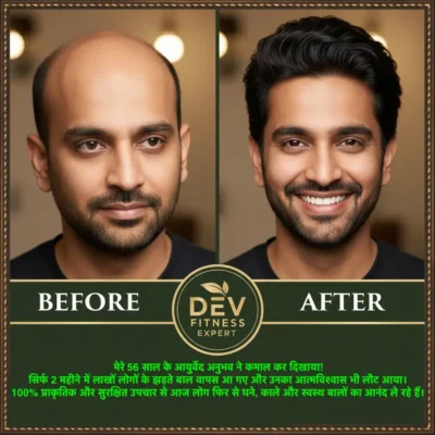 Ayurvedic treatment for baldness
